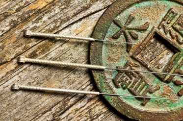 acupuncture needles on table