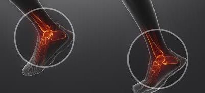 X-ray of healthy ankle joints