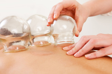 Cupping acupuncture therapy